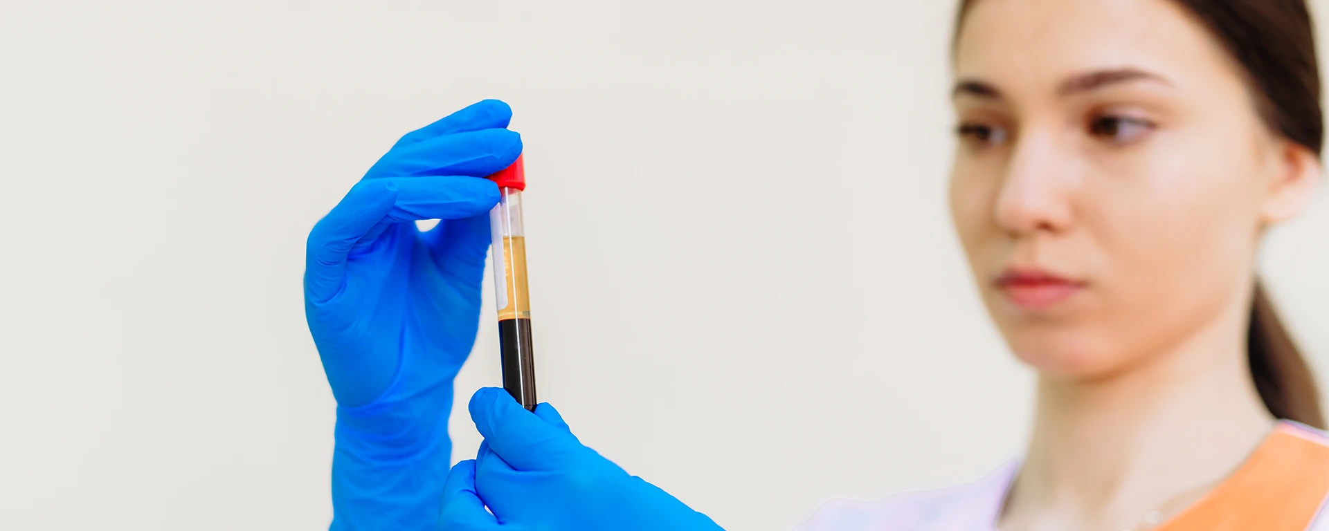 Best Platelet-Rich Plasma Therapy in Surat