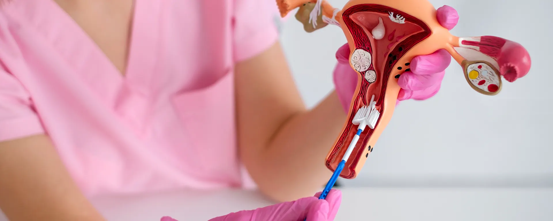 Best Hysteroscopic Septal Resection in Surat