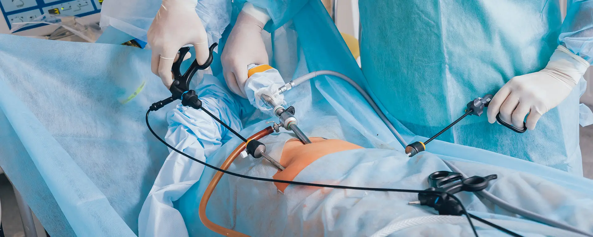 Best Laparoscopic Hysterectomy in Surat