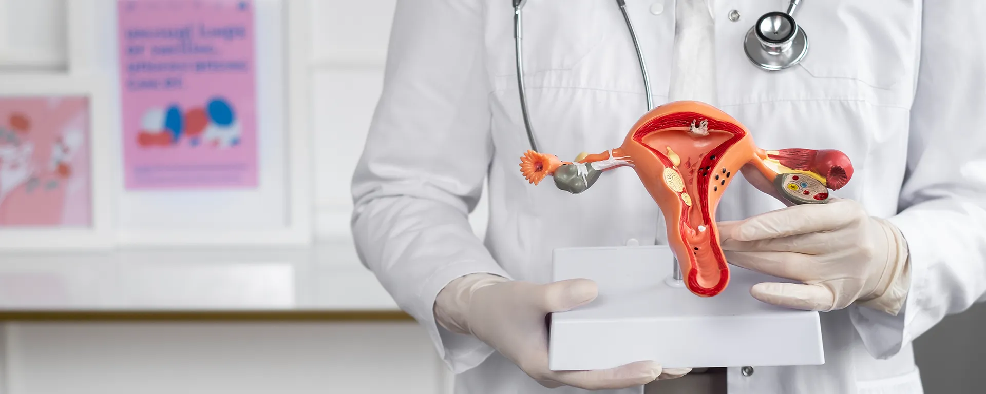 Best Laparoscopic Myomectomy in Surat