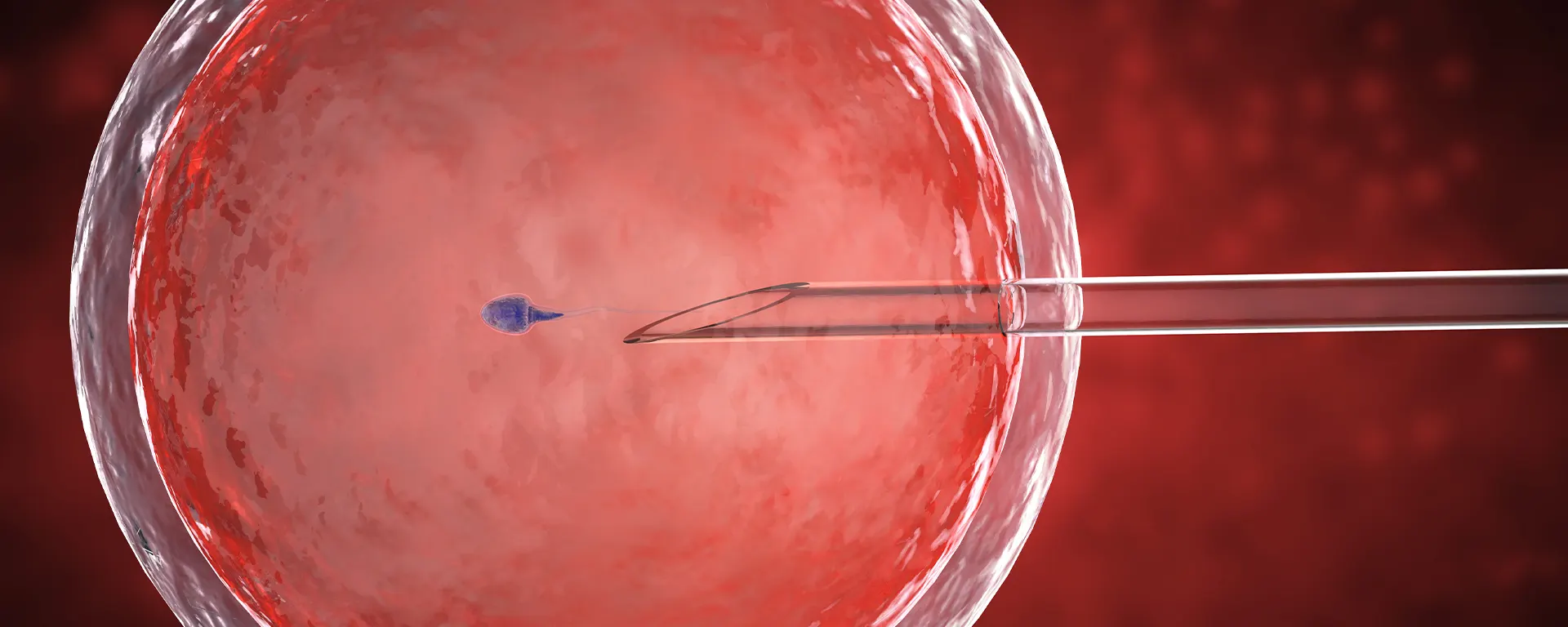 Best Micro-TESE in Surat