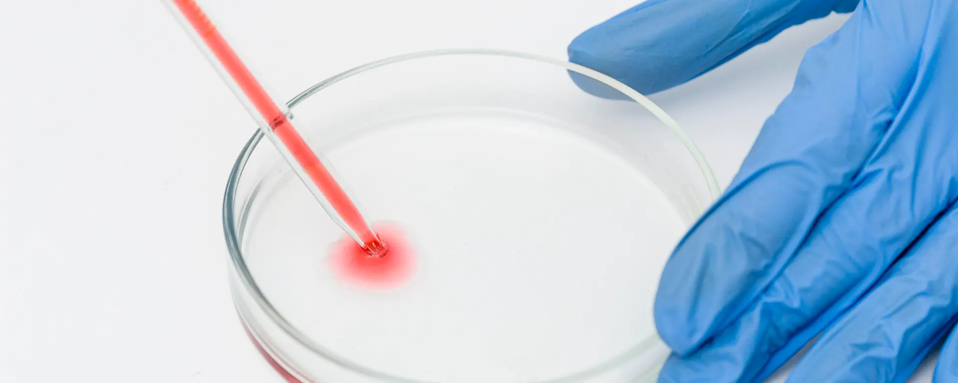 Best Semen Analysis & DFI (DNA Fragmentation Index) in Surat