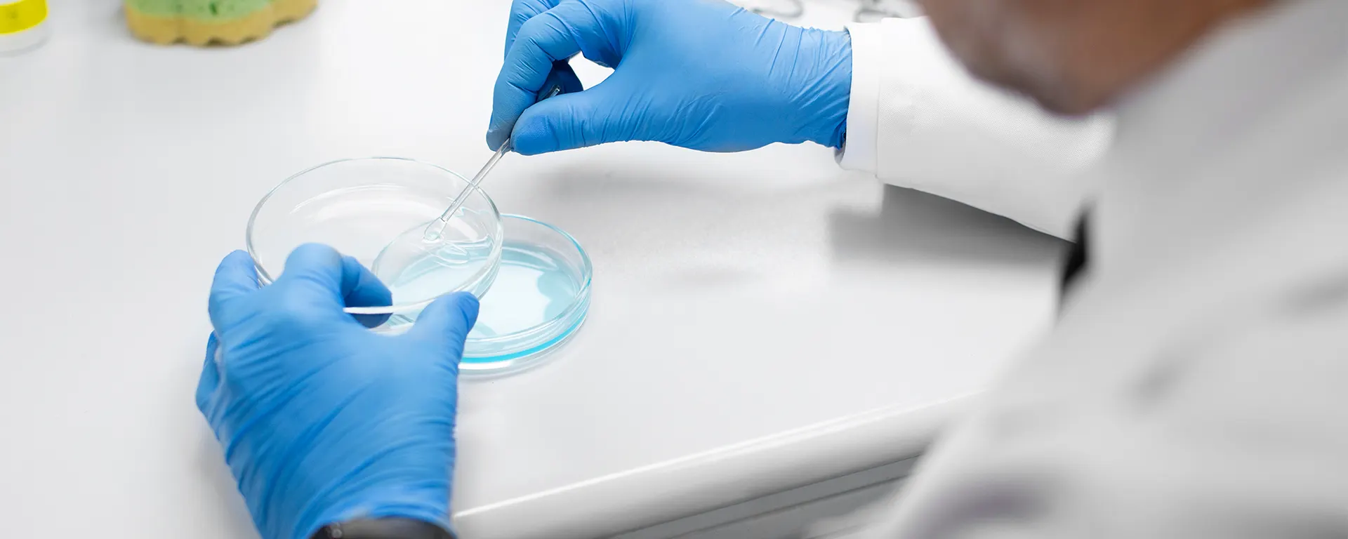 Best Testicular Sperm Extraction (TESE) in Surat