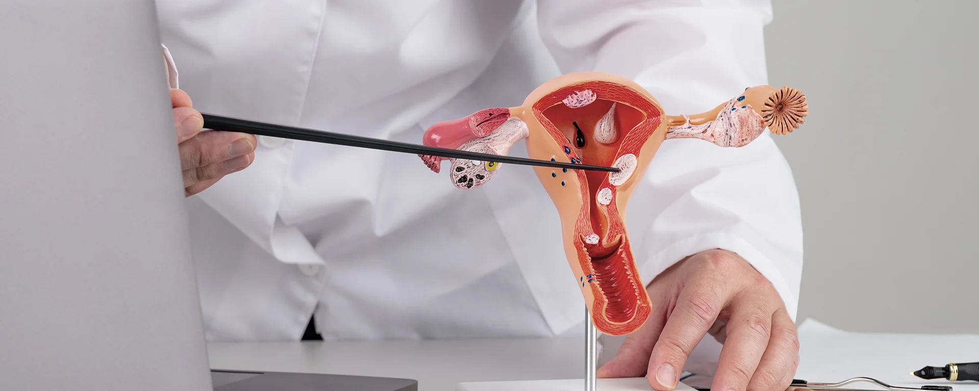 Best Tubal Recanalization in Surat