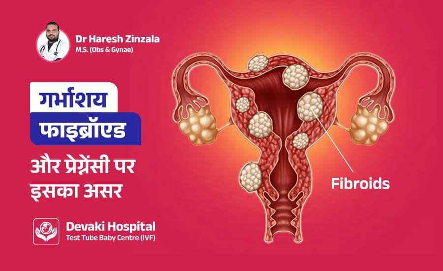 गर्भाशय फाइब्रॉएड (Fibroids) और प्रेग्नेंसी पर इसका असर